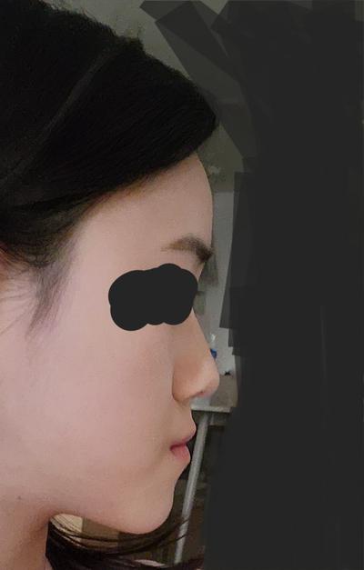 후기 사진 1
