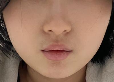 후기 사진 1