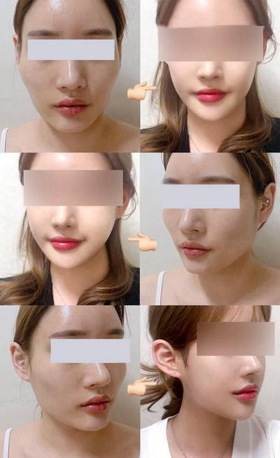 후기 사진 1