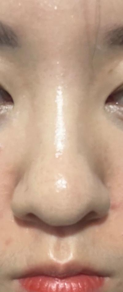 후기 사진 1