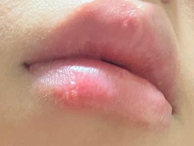 후기 사진 1