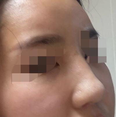 후기 사진 2