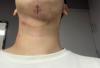 후기 사진 1