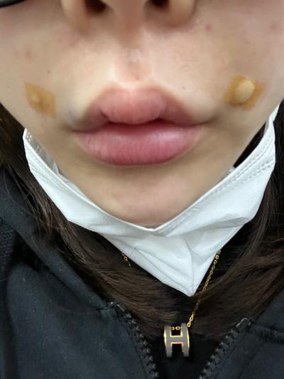 후기 사진 1