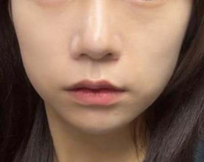 후기 사진 1