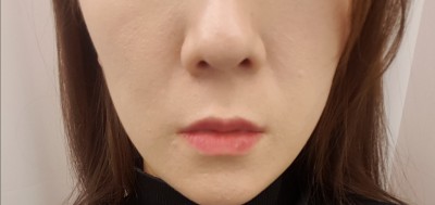 후기 사진 1