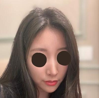 ํ๊ธฐ ์ฌ์ง 1