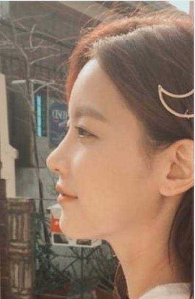 후기 사진 1