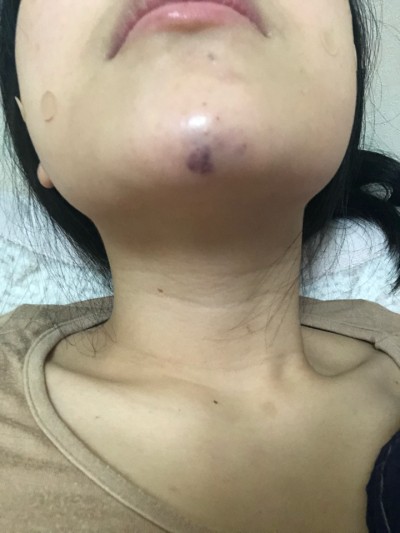 후기 사진 1