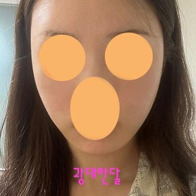 후기 사진 1