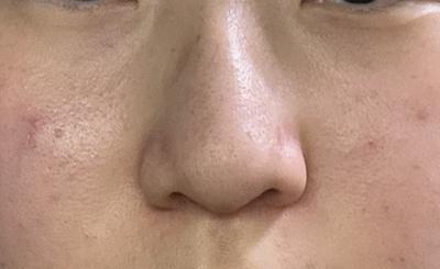 후기 사진 1