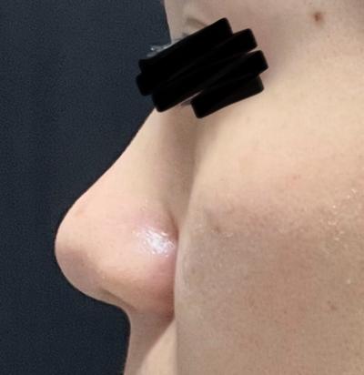 후기 사진 1
