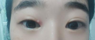 후기 사진 1