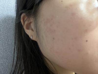 후기 사진 1