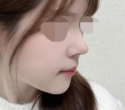 후기 사진 1