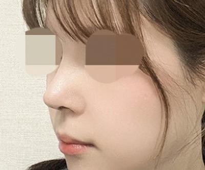 후기 사진 3