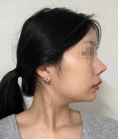 후기 사진 2