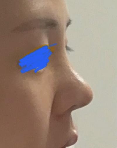 후기 사진 1