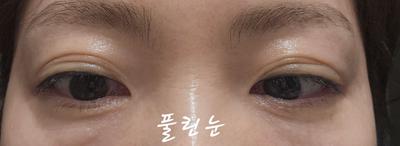 후기 사진 2