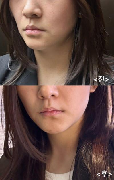 후기 사진 1