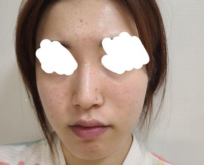 후기 사진 1