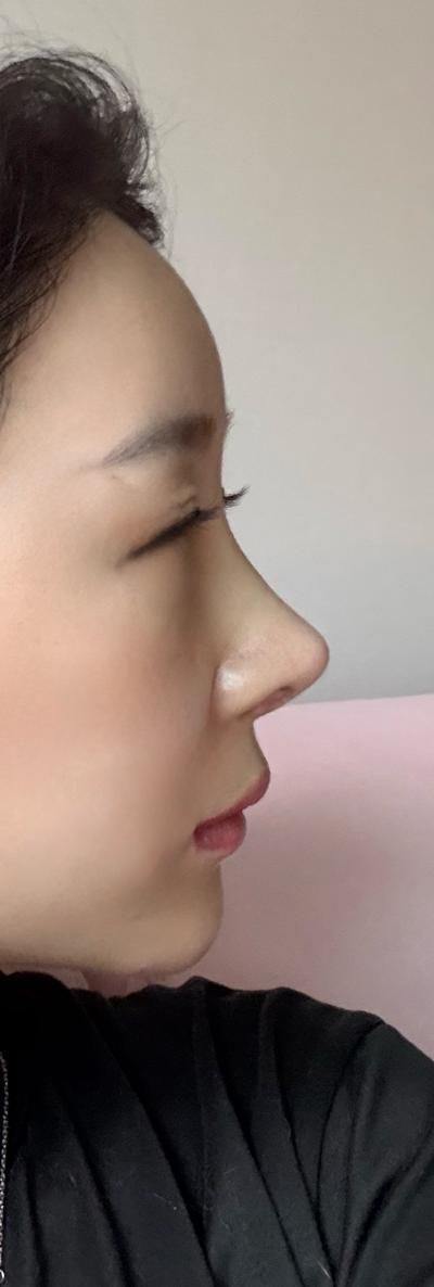 후기 사진 1