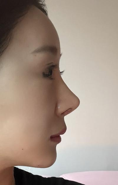 후기 사진 2