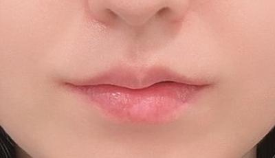 후기 사진 1