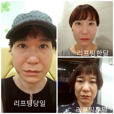 후기 사진 1