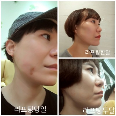 후기 사진 2
