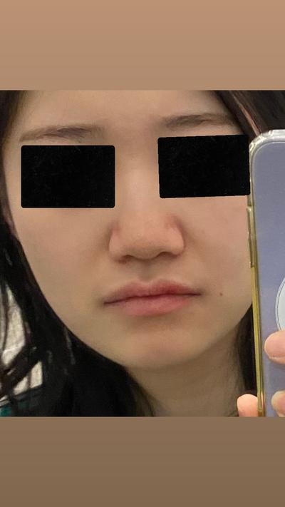 후기 사진 1