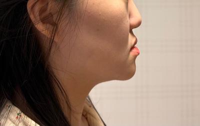 후기 사진 2