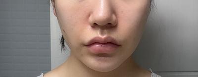 후기 사진 1