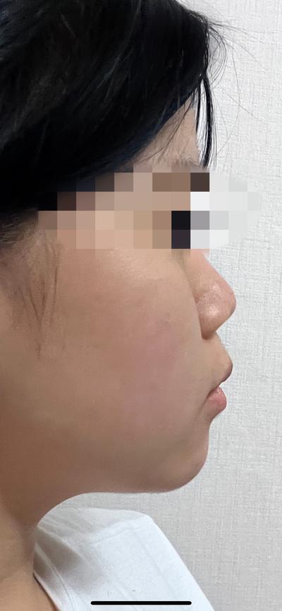 후기 사진 1