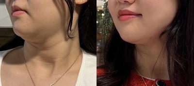 후기 사진 3