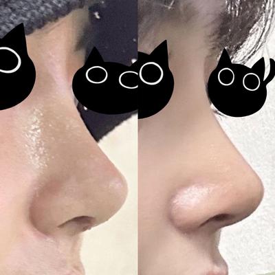 후기 사진 1