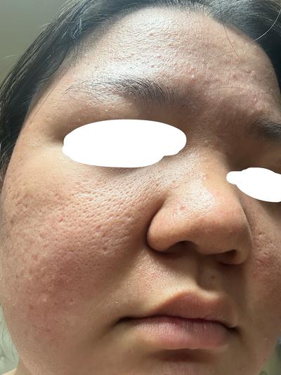 후기 사진 1