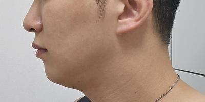 후기 사진 1