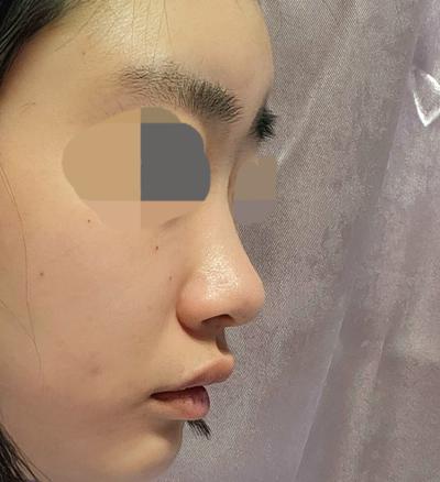 후기 사진 2