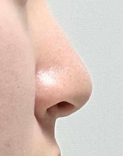 후기 사진 2