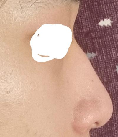 후기 사진 1