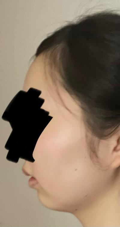 후기 사진 2