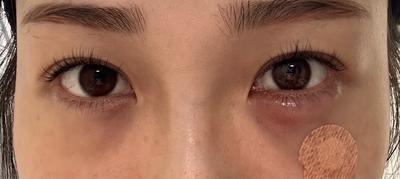 후기 사진 1