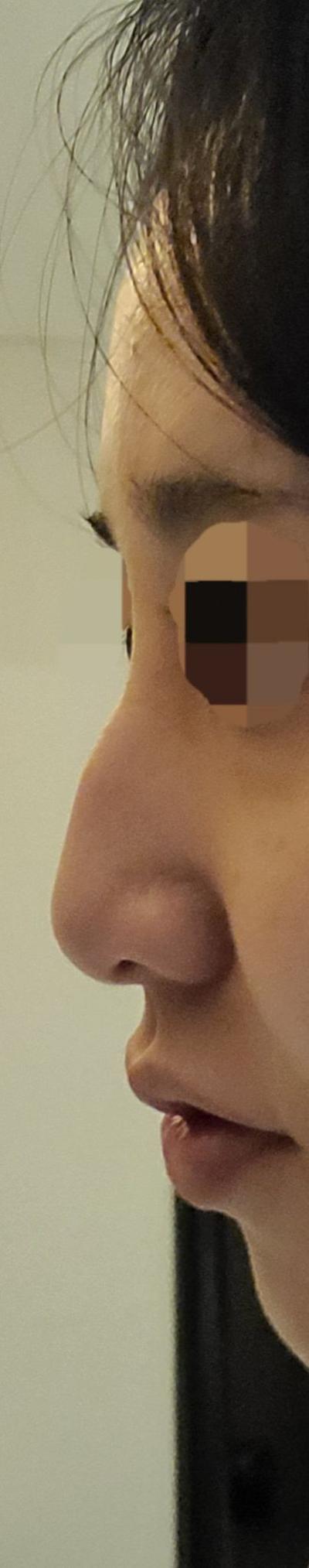 후기 사진 2