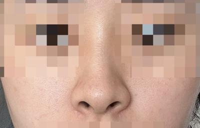 후기 사진 2