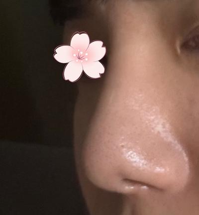 후기 사진 1