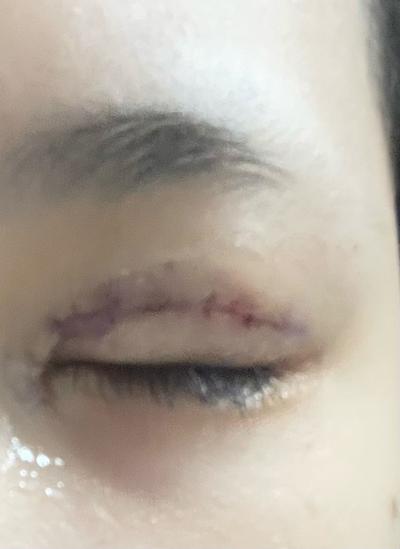 후기 사진 2