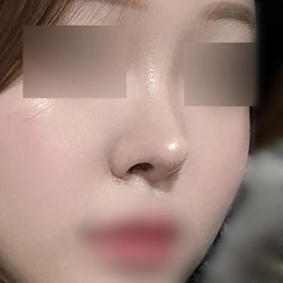 후기 사진 2