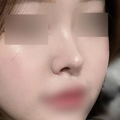 후기 사진 1