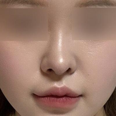 후기 사진 4